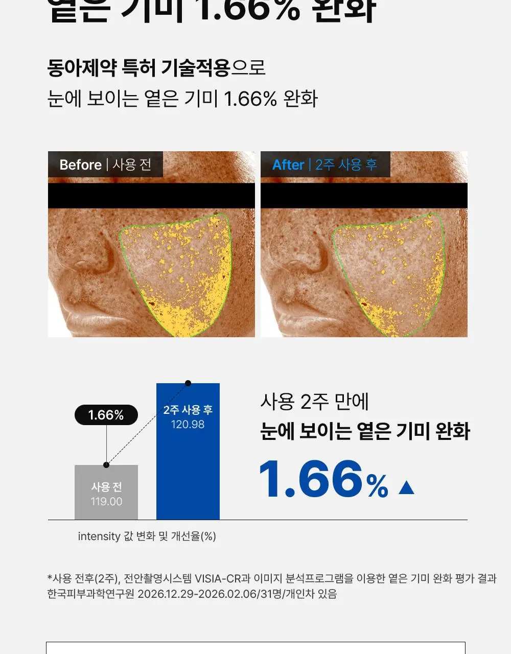 [단독기획] 동아제약 색소침착 프로 액제 30ml 기획(+크림제5ml) 상세페이지 13